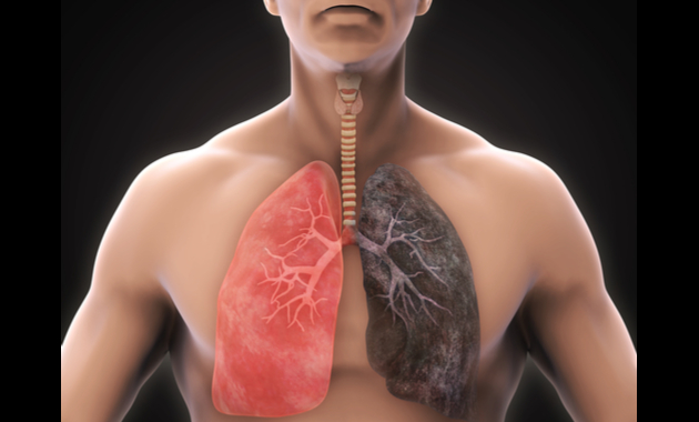 How Smoking Affects Your Lungs Tata 1mg Capsules