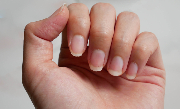 Brittle Nails Causes Treatment And Tips Tata 1mg Capsules